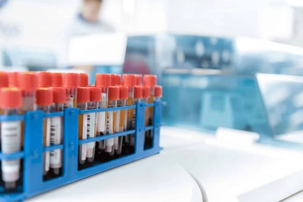 Diagnostic Reagents